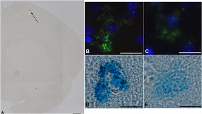 Brain Histamine Modulates the Antidepressant-Like Effect of the 3-Iodothyroacetic Acid (TA1)